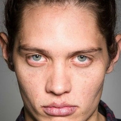 AD